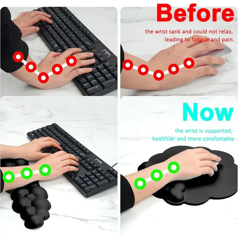 Cloud-Shaped Cute Keyboard Wrist Rest Set with Mouse Pad Support, Ergonomic Gaming Arm Rest for Home and Office Desks, Laptops Outdoorfun White, Pc Gaming Setup, Pc Accessories Stylish Breathable